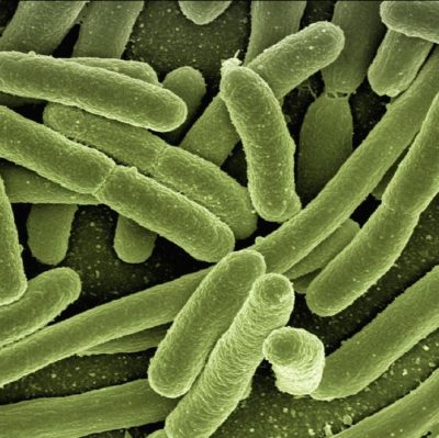 Legionella